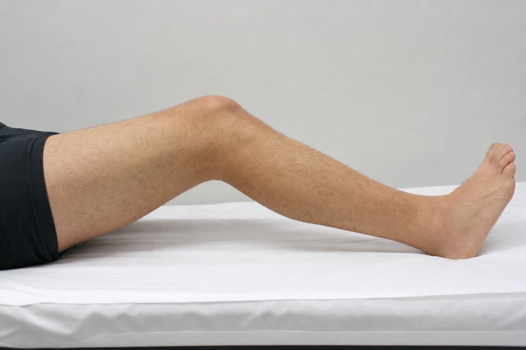 Unable to Straighten the Knee