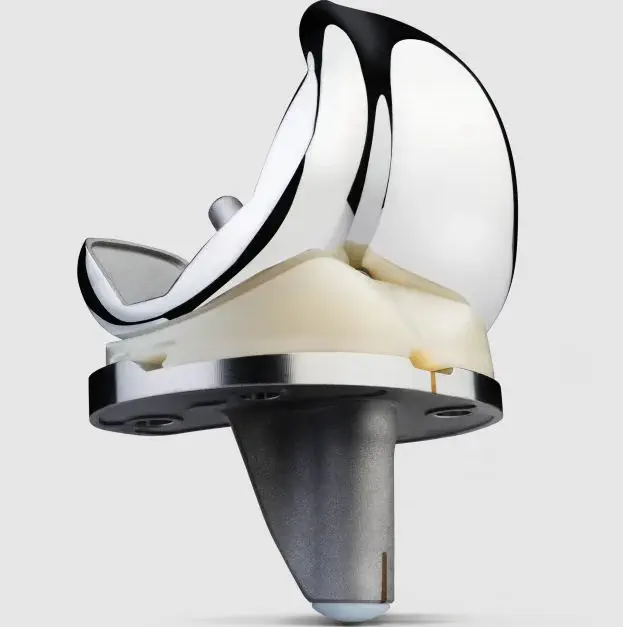 How Long Does a Knee Replacement Last? Modern Data, Lifespan, and Expectations